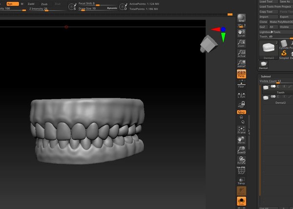 Dental prosthesis modelling 3D model - TurboSquid 1656597