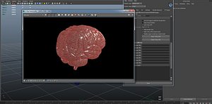 Brain