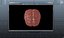 Brain
