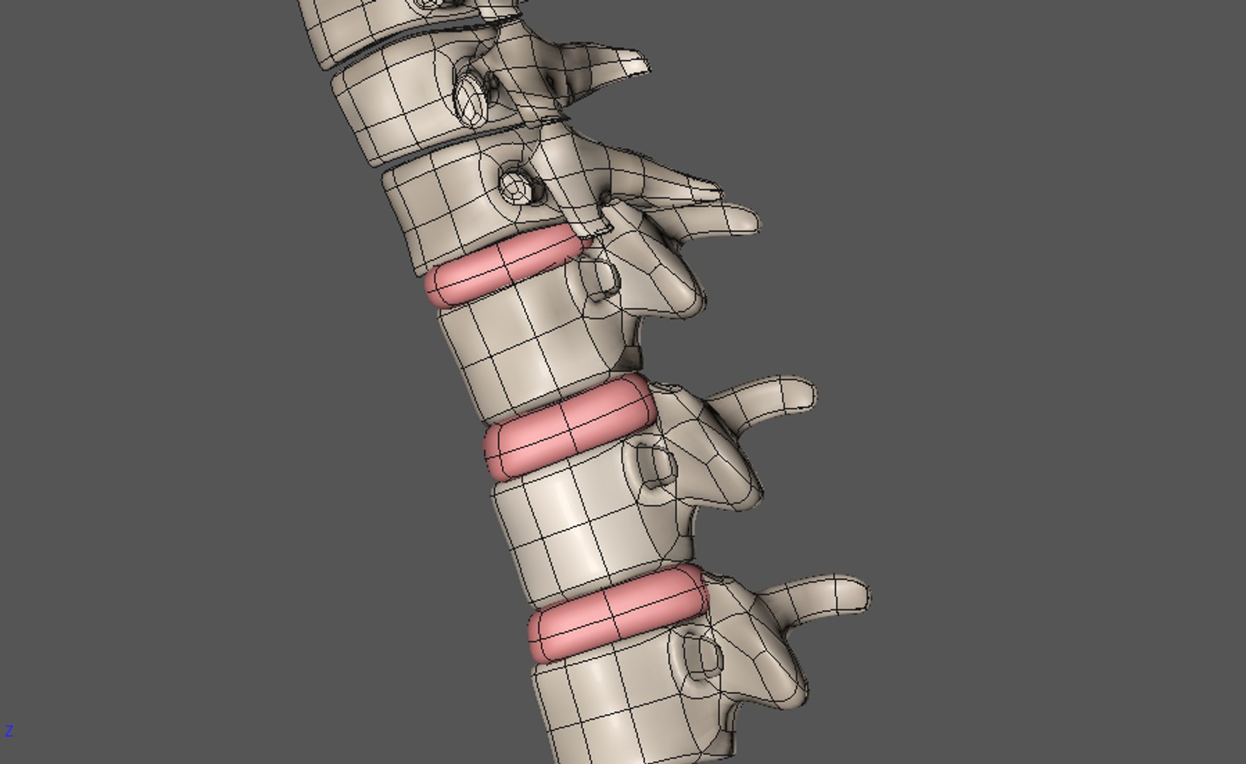 3d Model Spine Spinal Decompression
