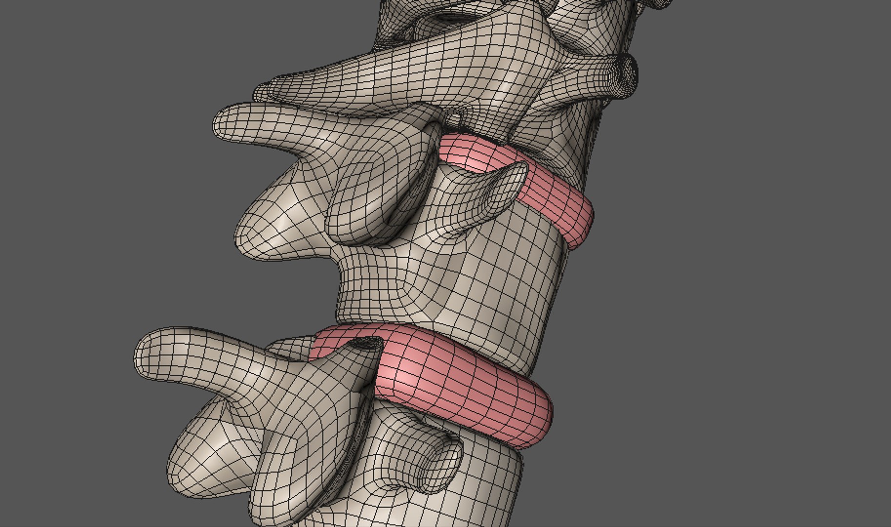 3d Model Spine Spinal Decompression