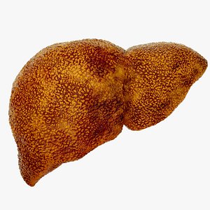 3D model Cirrhosis  liver disease digestive system organs