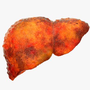 3D model Liver cysts liver disease  digestive system organs