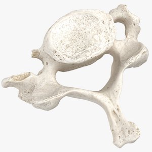 Real Cervical Vertebrae C7 Broken White