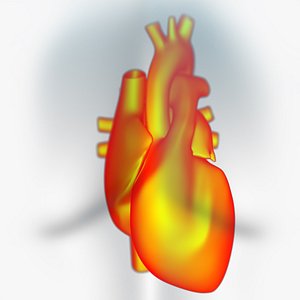 3D Heart X-Ray