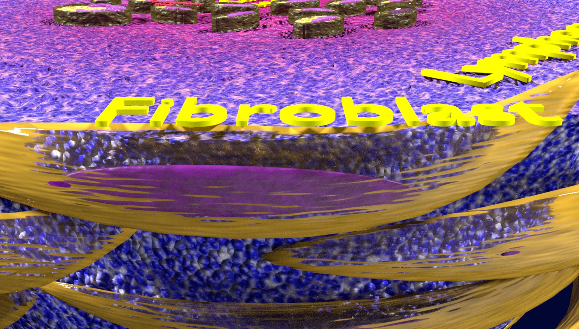 3D Tubercular Caseating Model - TurboSquid 1592510