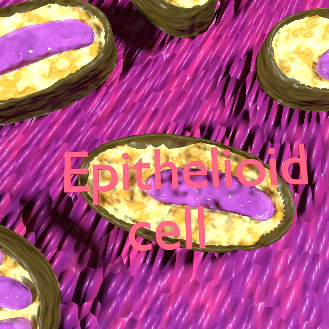3D Tubercular Caseating Model - TurboSquid 1592510