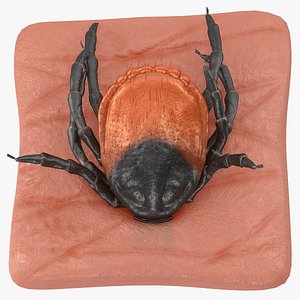 Tick Stuck in Skin Fur