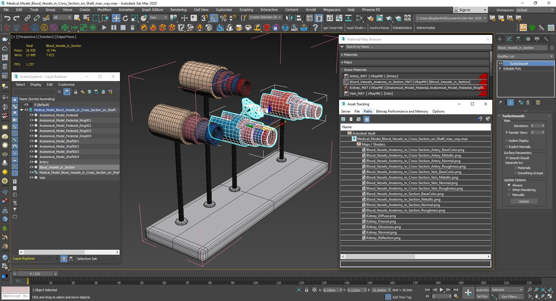 3D model Medical Model Blood Vessels in Cross Section on Shaft https://p.turbosquid.com/ts-thumb/DA/wfg89k/d7/medical_model_blood_vessels_in_cross_section_on_shaft_016/jpg/1744299834/1920x1080/fit_q87/0e1844d7f3edeaa58a5436f2d4d7ec77f14a8320/medical_model_blood_vessels_in_cross_section_on_shaft_016.jpg