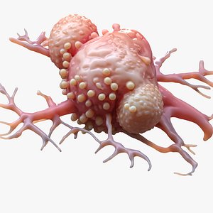 3D model Cancer Cell Tumor