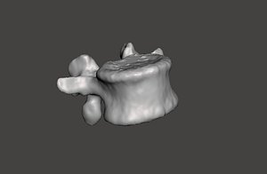 Human vertebrae