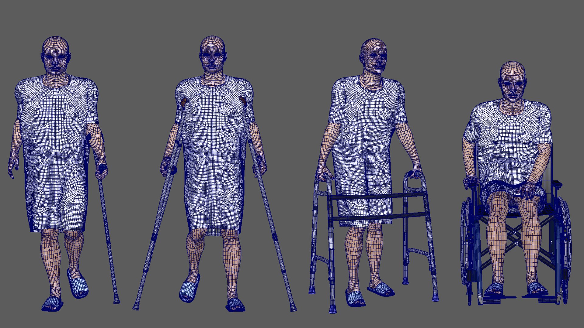 3D Patients Model Collections - Blue Dress https://p.turbosquid.com/ts-thumb/DQ/UrfE79/df/014/png/1636466632/1920x1080/fit_q87/38a5b8d861ddfb1bf355b9d89df319a00684b380/014.jpg