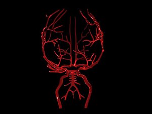 brain arteries 3ds