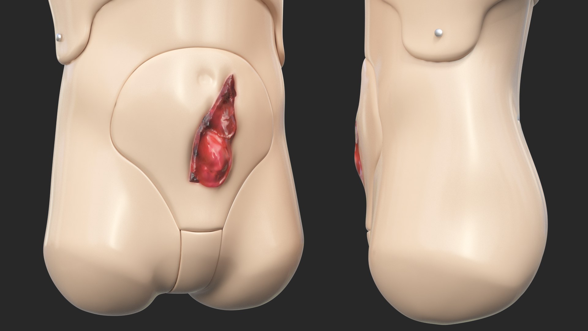 injured firstaid mannequin body model https://p.turbosquid.com/ts-thumb/DW/qResLP/EOfDN21X/injuredfirstaidmannequinbody3dsmodel016/jpg/1582317371/1920x1080/fit_q87/1a6e83c384cfced7189eb8327b34bdcef720db34/injuredfirstaidmannequinbody3dsmodel016.jpg