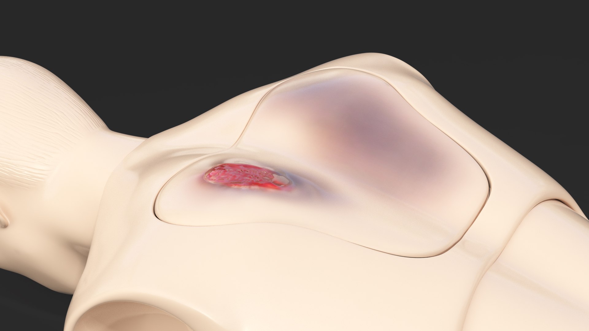 injured firstaid mannequin body model https://p.turbosquid.com/ts-thumb/DW/qResLP/UAYton7e/injuredfirstaidmannequinbody3dsmodel011/jpg/1582317341/1920x1080/fit_q87/b0fc48b965948b6b4ecaedbea0df92994f699b1e/injuredfirstaidmannequinbody3dsmodel011.jpg