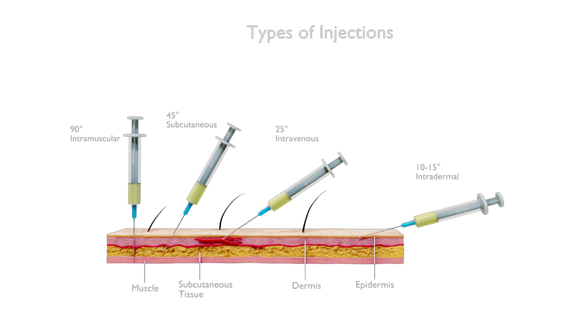 3D Model Types Of Injections With Animation - TurboSquid 2508248