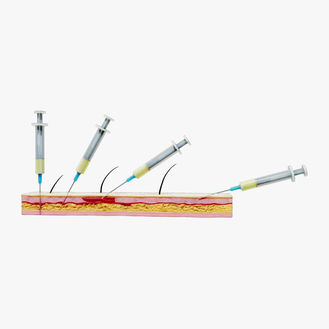 3D Model Types Of Injections With Animation - TurboSquid 2508248
