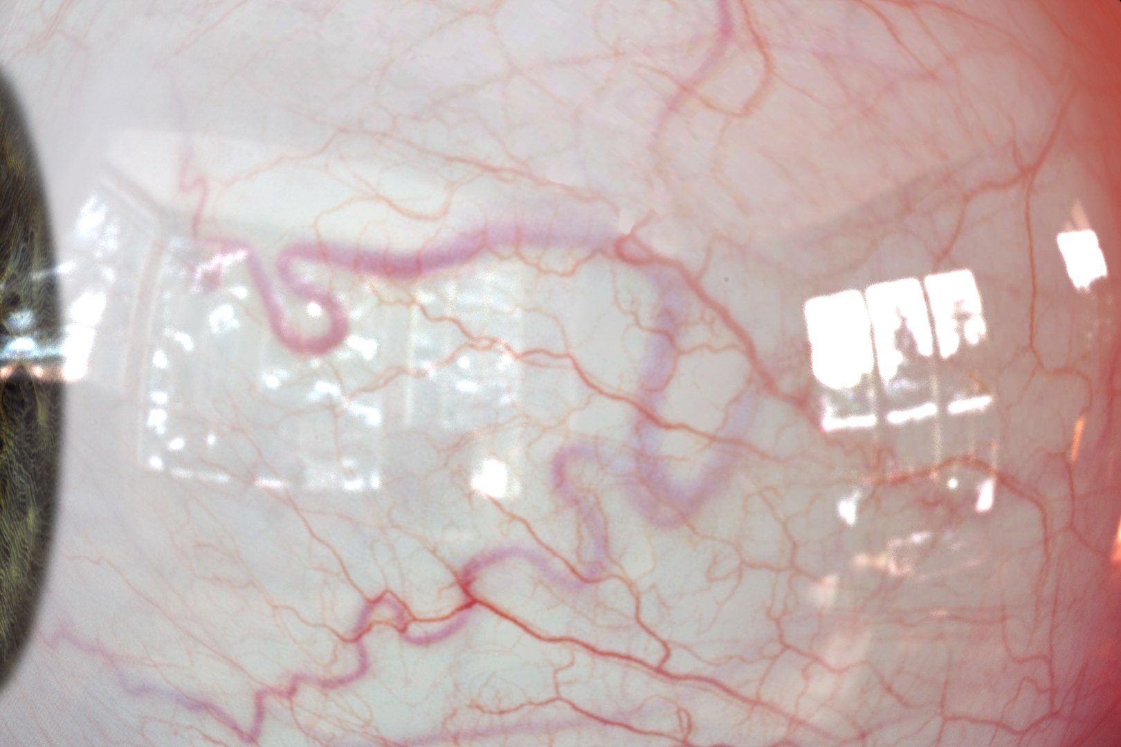 realistic human eye 3D https://p.turbosquid.com/ts-thumb/Dc/jUaBwB/OZ1jEHuf/a_4_2/jpg/1539295746/1920x1080/fit_q87/c5f7d687e27e7a09cc63ebb4cd8f0004c10c9606/a_4_2.jpg