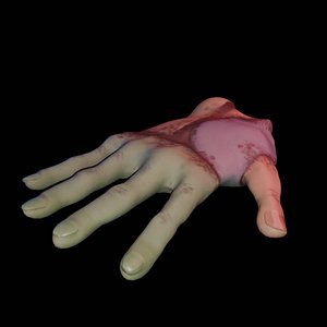 3D injured hand