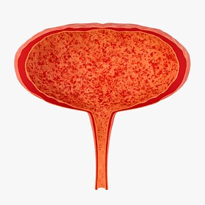 Cystitis  inflammation  urinary system diseases