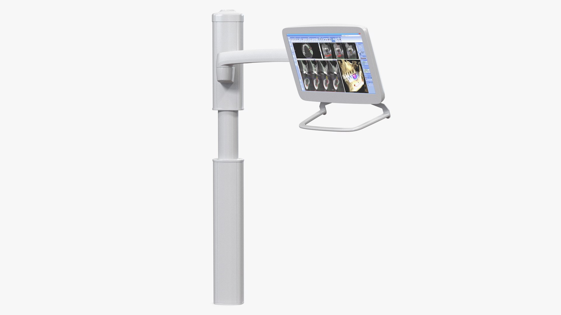 Post Mounted Dental LCD Display 3D model preview