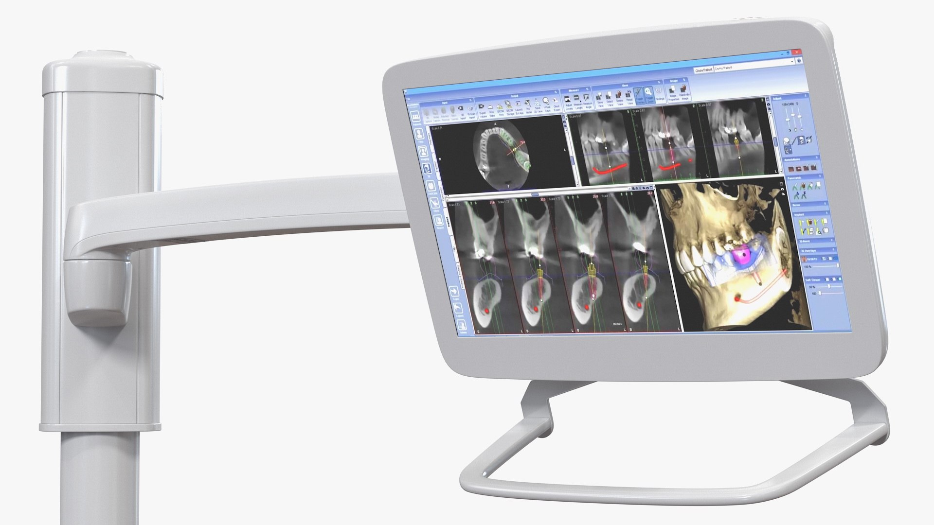 3D post mounted dental lcd display model https://p.turbosquid.com/ts-thumb/Dp/HyRQGt/hDgEKzf6/postmounteddentallcddisplay3dmodel009/jpg/1594546544/1920x1080/fit_q87/d63dd742acfd5d58d8e27edf003654ea39630662/postmounteddentallcddisplay3dmodel009.jpg