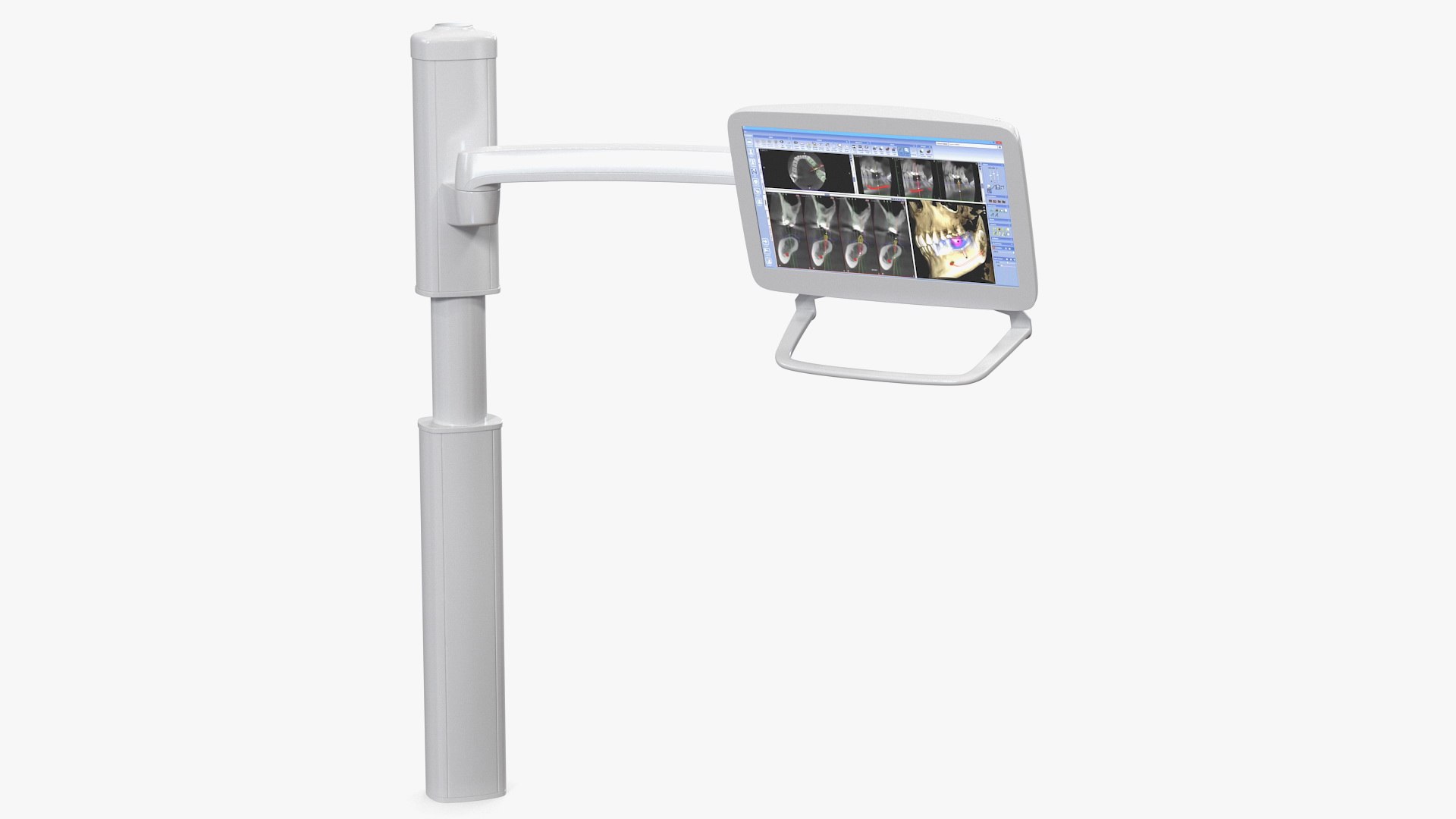 3D post mounted dental lcd display model https://p.turbosquid.com/ts-thumb/Dp/HyRQGt/hP5H8Wr2/postmounteddentallcddisplay3dmodel008/jpg/1594546537/1920x1080/fit_q87/2b4841a5c71bbd6fb51ccdb76aed981a3101cf9b/postmounteddentallcddisplay3dmodel008.jpg