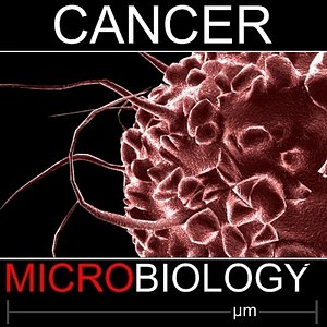 Cancer Cell