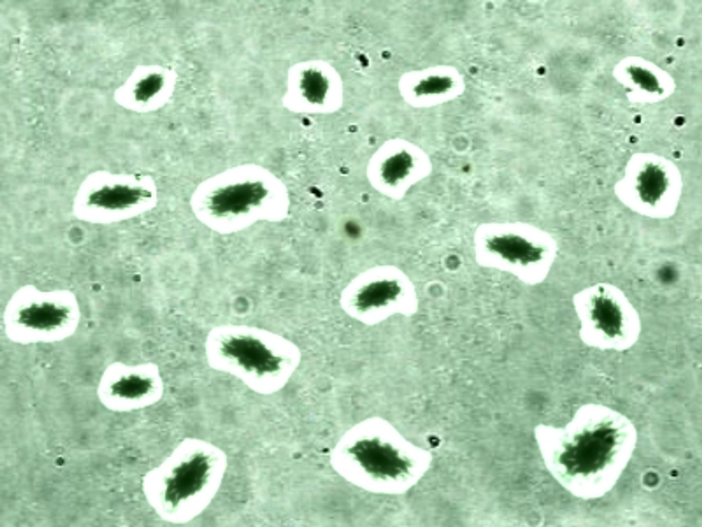 Max Realistic Amebas