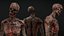 Recurso de cadáver humano