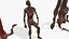 Recurso de cadáver humano