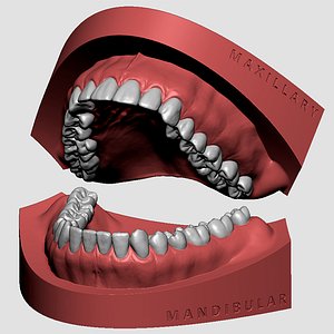Maxillary and Mandibular dental 3D print model