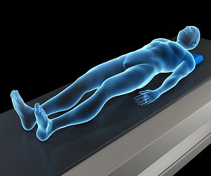 3D Medical Body Scan