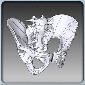 Pelvis Solidworks