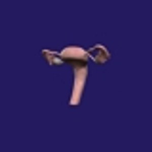 3D Uterus model