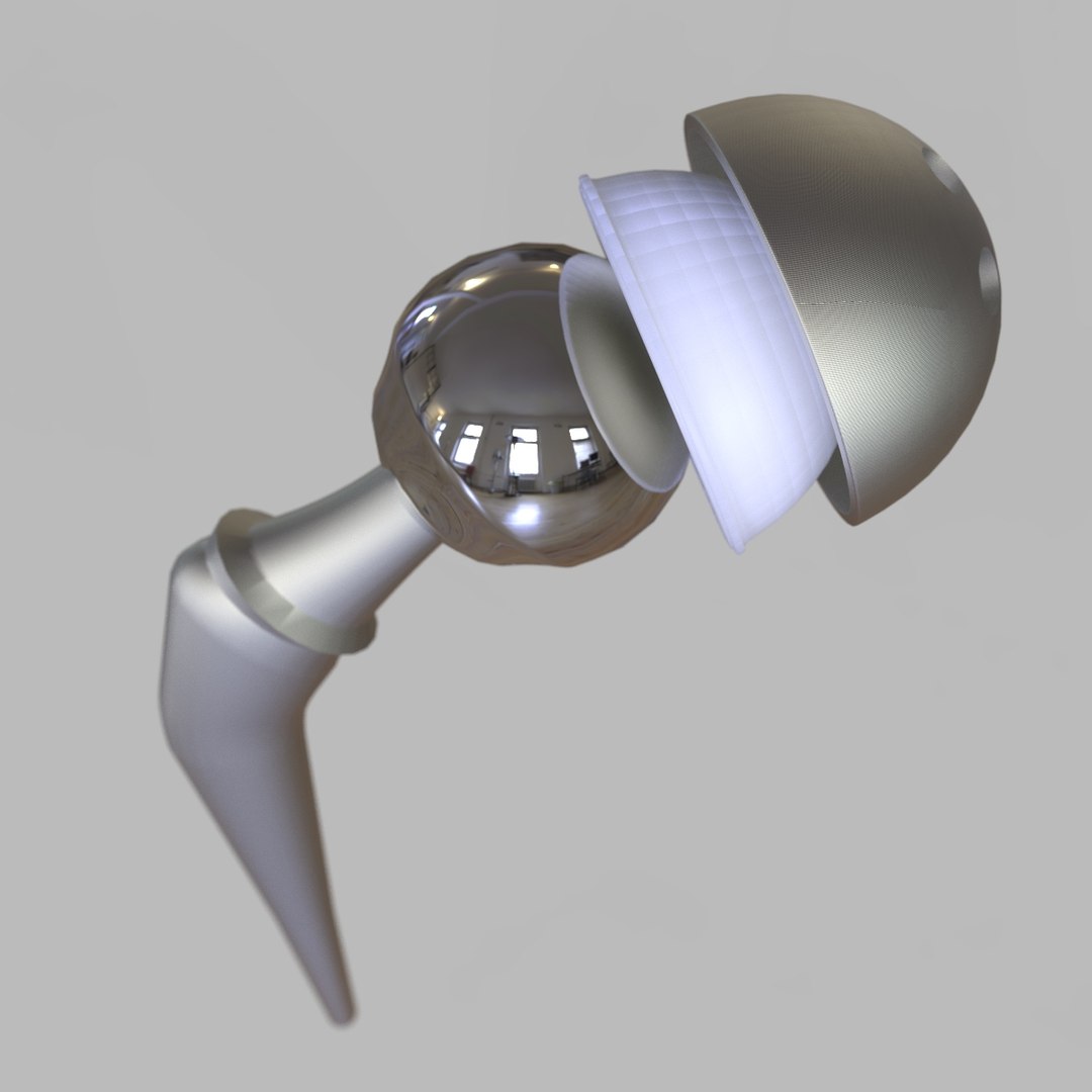 replacement hip 3D https://p.turbosquid.com/ts-thumb/EL/VAB07C/WJVq6zVX/image9/jpg/1583700466/1920x1080/fit_q87/b3a059914e65e13197e25ad29c222c19c55cadf7/image9.jpg