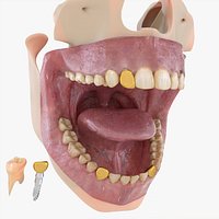 Mouth, Teeth, Grill and Implant