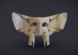Sphenoid bone