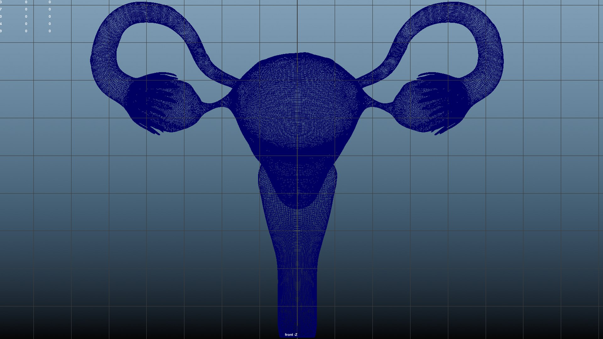 3D Uterine Lesions Uterine Fibroids Gynecological Diseases Model ...