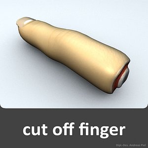 cut off finger