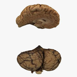 Human Brain Collection