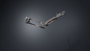 3D Prosthetic trash arm model