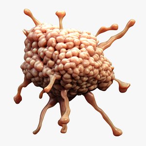 Cancer Cell Tumor