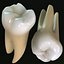 Second Molars