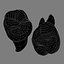 Second Molars