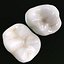 Second Molars