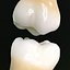 Second Molars
