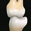 Second Molars