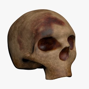 Skull