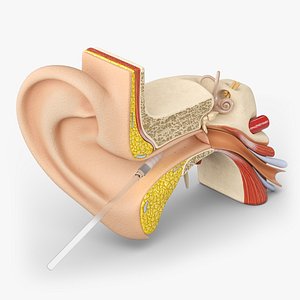 Otoscopy Simulation Model with Ear Cleaning Tool